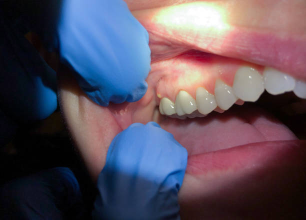 Best Dentist Open Late Near Me  in Saks, AL